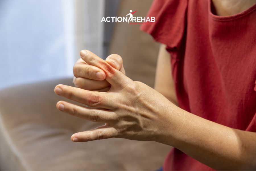 Volar plate injuries | action rehab