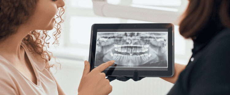 selective-focus-x-ray-picture-teeth-tablet selective focus x ray picture teeth tablet