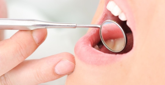 Dentists teeth checkup
