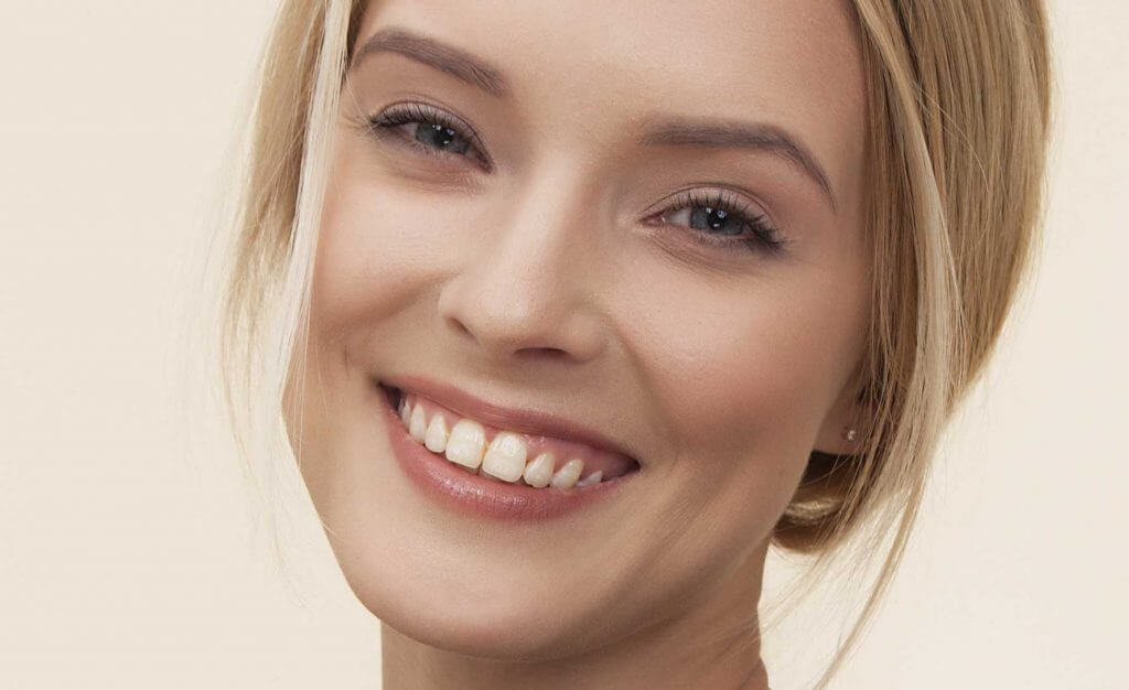 White teeth with pale yellow blemishes