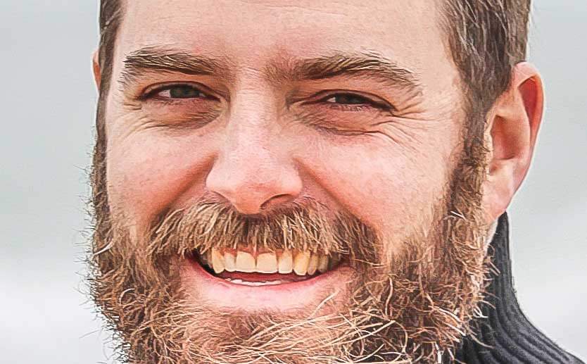 Teeth naturally age and become more yellow in colour