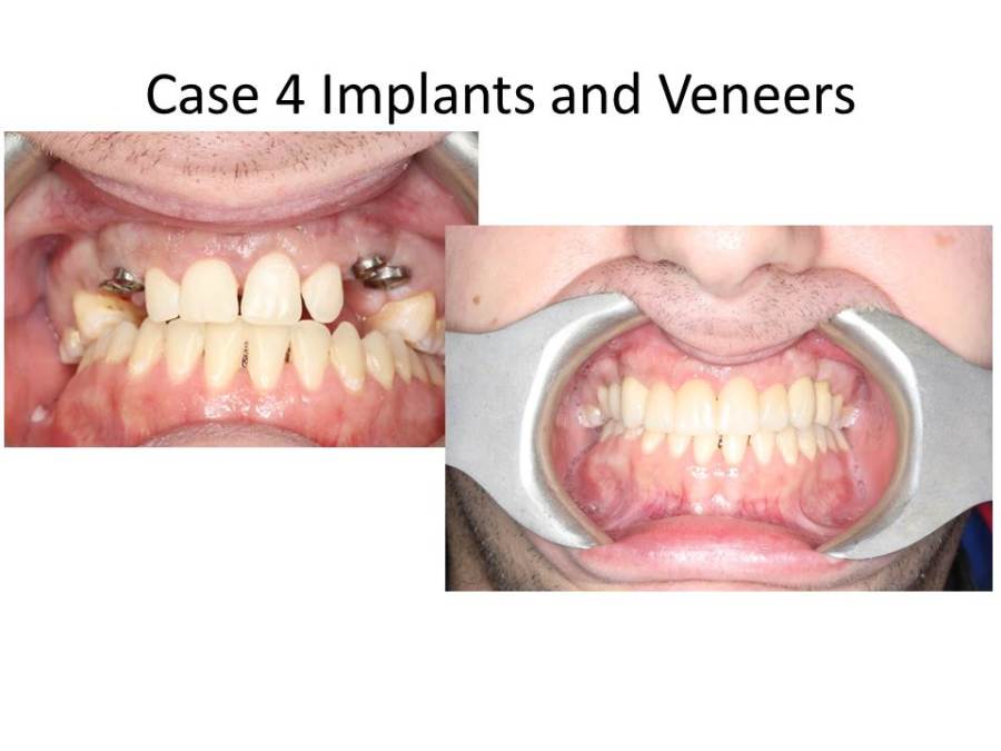 Case41of1_srcset-large Case41of1_srcset-large