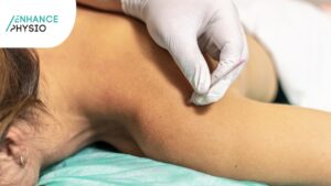 Wodonga Dry Needling in Physiotherapy Plan | Enhance Physiotherapy
