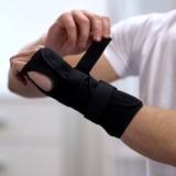 Broken Wrist Splint and Cast | Action Rehab Hand Therapy Clinic