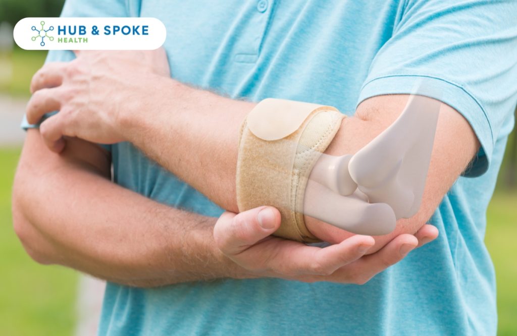 How to Manage Tennis Elbow with Physio in Melbourne | Hub And Spoke Health
