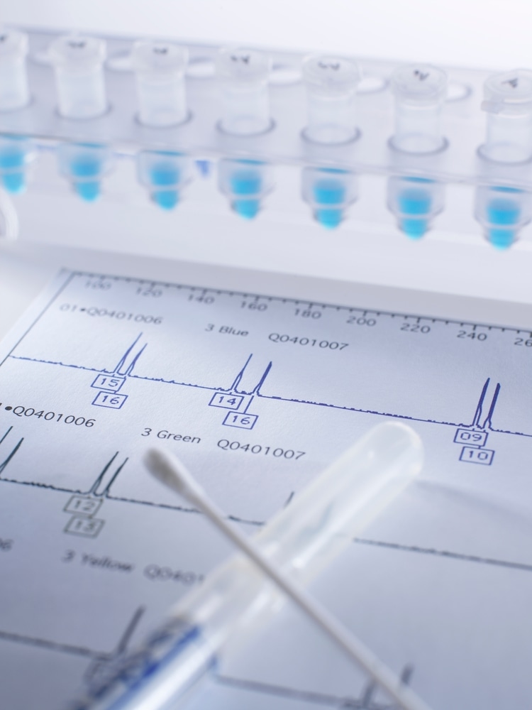 Samples,And,Swab,Containing,Dna,Sample,On,Genetic,Testing,Results