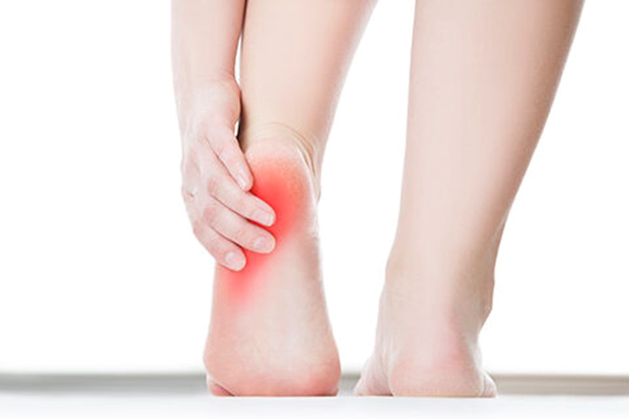 Should I See a Physio or a Chiropodist for Plantar Fasciitis