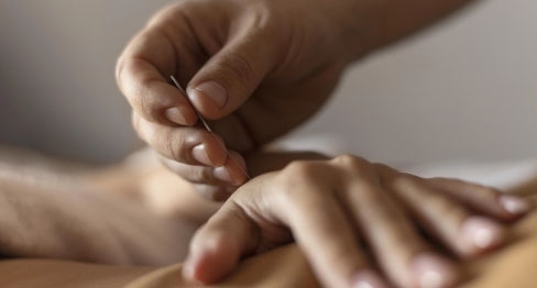 close-up-hand-holding-acupuncture-needle clouse up hand holding acupuncture needle