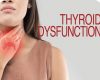 thyroid health treatment sydney