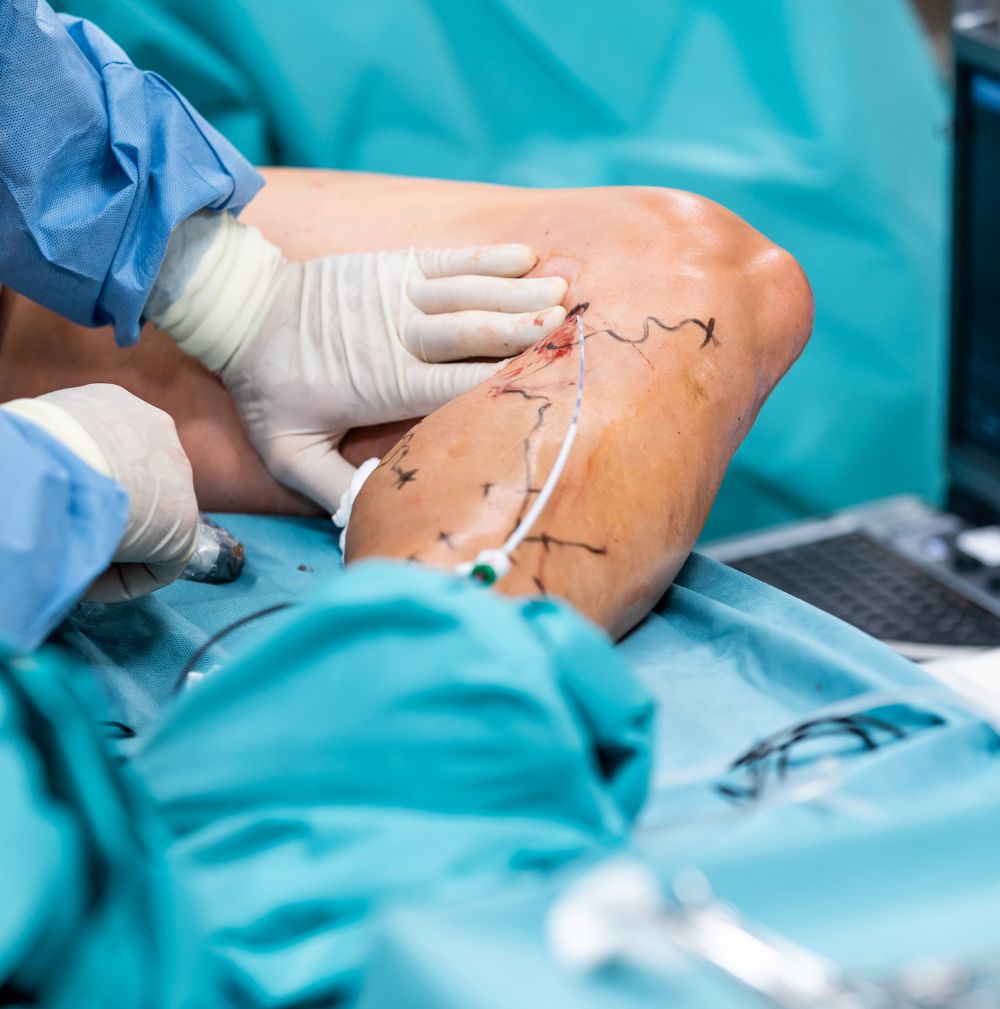 HIPAA-certified virtual medical assistant streamlining vascular surgery workflows with patient scheduling, insurance verification, and EMR documentation on secure platforms