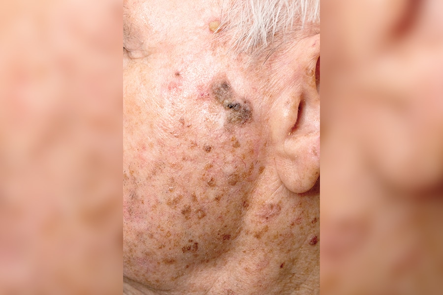 Skin Cancer Clinic Bowral